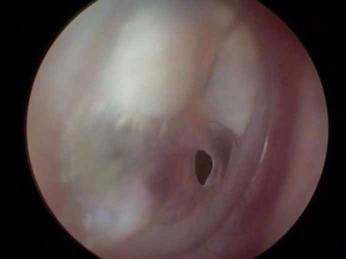 CHIRURGIA DELL’ORECCHIO