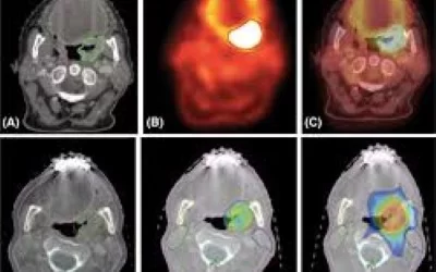 CHIRURGIA ONCOLOGICA DELLA TESTA E DEL COLLO